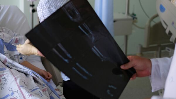 Врач смотрит на рентген снимок пациента. Архивное фото - Sputnik Кыргызстан