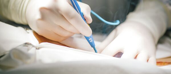 Операция по удалению злокачественной опухоли - Sputnik Кыргызстан