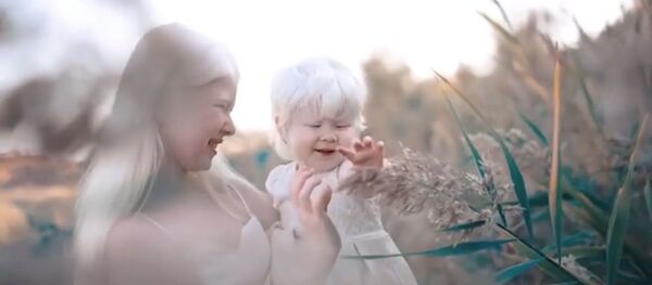 Сестры-альбиносы из Казахстана покоряют Сеть — видео об уникальных девочках - Sputnik Кыргызстан