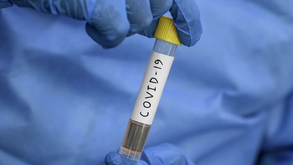 Сотрудник лаборатории держит пробирку с образцом для тестирования на коронавирус COVID-19. Архивное фото - Sputnik Кыргызстан