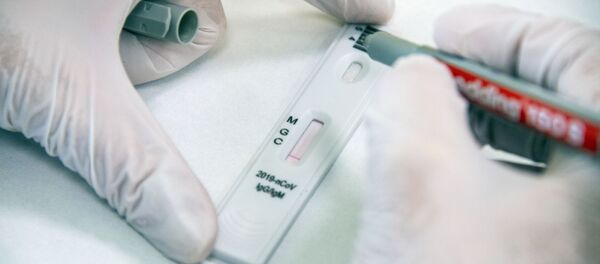 Экспресс-диагностика на антитела к коронавирусу в клинике Hadassah Medical Moscow в Сколково - Sputnik Кыргызстан