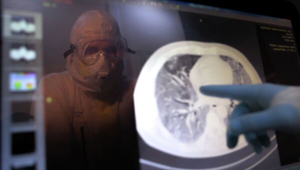Медицинский работник в стационаре для больных указывает на снимок легких. Архивное фото  - Sputnik Кыргызстан