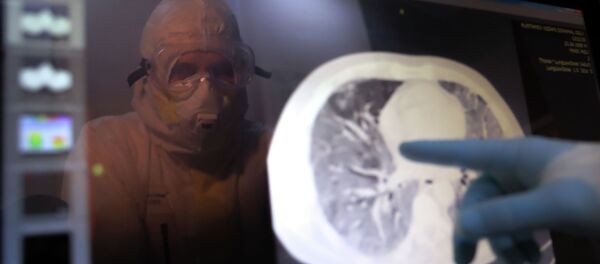 Медициналык кызматкер өпкөнүн томографиялык сүрөтүн карап жатат. Архив - Sputnik Кыргызстан