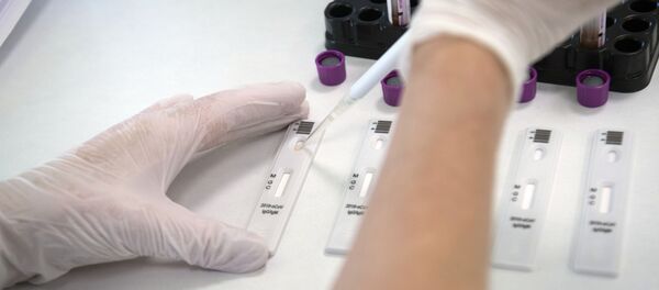 Экспресс-диагностика на антитела к коронавирусу в клинике Hadassah Medical Moscow в Сколково - Sputnik Кыргызстан