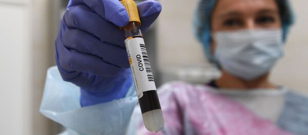Пробирка с кровью для анализа на антитела к коронавирусу COVID-19 Пробирка с кровью для анализа на антитела к коронавирусу COVID-19 - Sputnik Кыргызстан