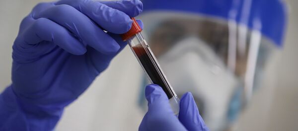 Тестирование на антитела к коронавирусу - Sputnik Кыргызстан