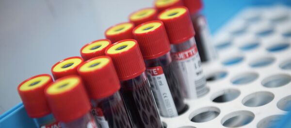 Пробирки с образцами крови для тестирования на коронавирус COVID-19 Пробирки с образцами крови для тестирования на коронавирус COVID-19 - Sputnik Кыргызстан