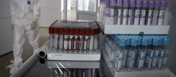 Госпиталь COVID-19 в Черкесске - Sputnik Кыргызстан