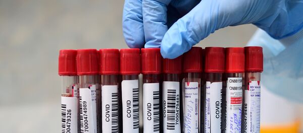 Коронавируска анализ жасоо үчүн алынган үлгүлөр - Sputnik Кыргызстан