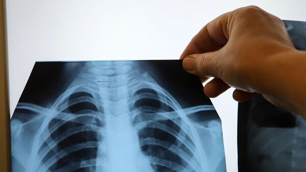 Врач с рентгеном легких в инфекционном корпусе, где лечат пациентов с COVID-19. Архивное фото - Sputnik Кыргызстан