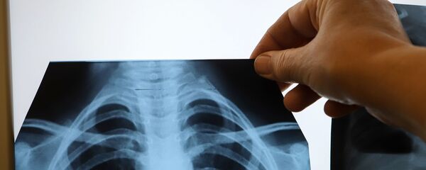 Врач рассматривает рентген пациента Врач рассматривает рентген пациента - Sputnik Кыргызстан