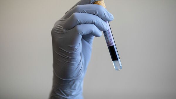 Образец крови для анализа на коронавирус. Архивное фото - Sputnik Кыргызстан