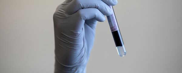 Образец крови для анализа на коронавирус - Sputnik Кыргызстан