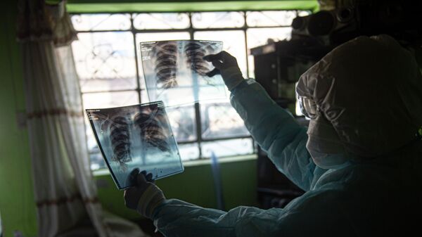 Врач держит рентген снимки. Архивное фото - Sputnik Кыргызстан