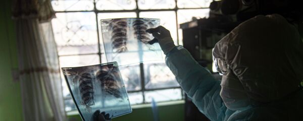 Врач проверяет рентгенограмму легких пациента - Sputnik Кыргызстан