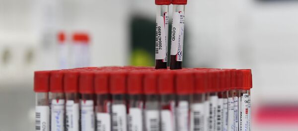 Контейнеры с биоматериалом для проверки на коронавирусную инфекцию. Архивное фото - Sputnik Кыргызстан