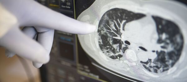 Госпиталь COVID-19 в УКБ №2 Первого МГМУ им. И. М. Сеченова Госпиталь COVID-19 в УКБ №2 Первого МГМУ им. И. М. Сеченова - Sputnik Кыргызстан