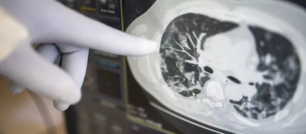 Госпиталь COVID-19 в УКБ №2 Первого МГМУ им. И. М. Сеченова - Sputnik Кыргызстан