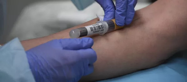 Тестирование на наличие антител к COVID-19. Архивное фото - Sputnik Кыргызстан